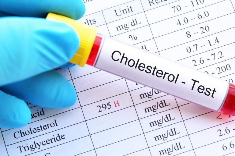 Menjaga Kolesterol Selama Lebaran